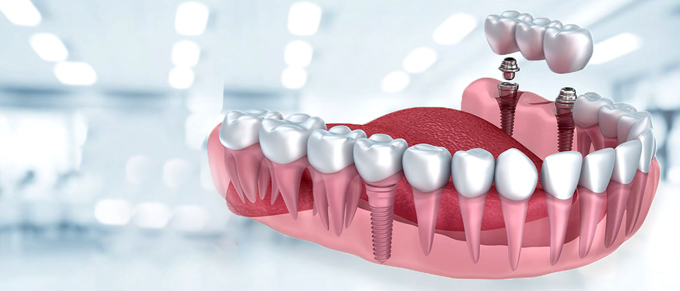 Merkamed Dental Medikal